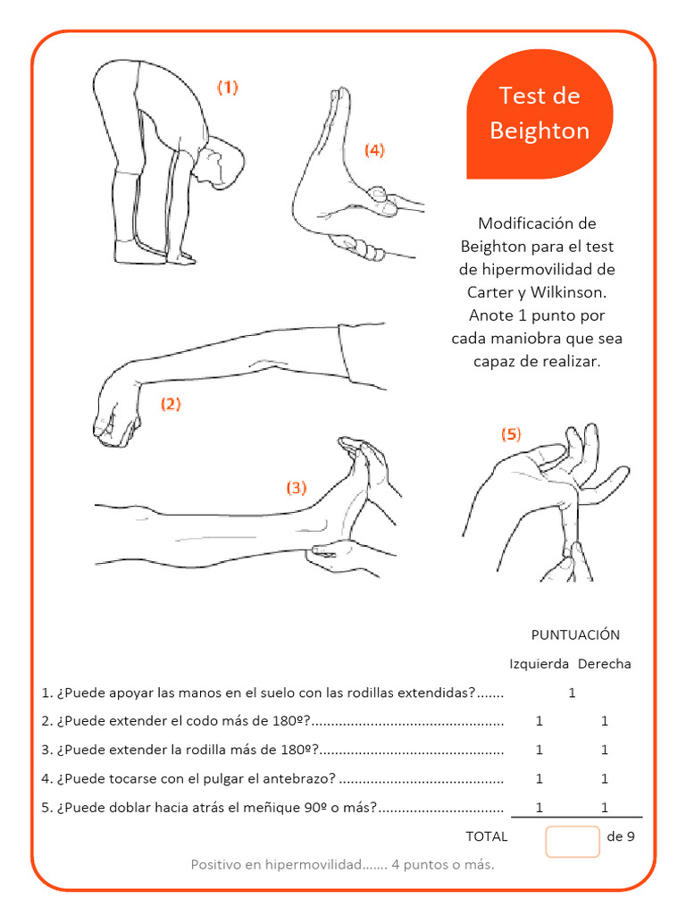 Test de Beighton para Hipermovilidad | PDF