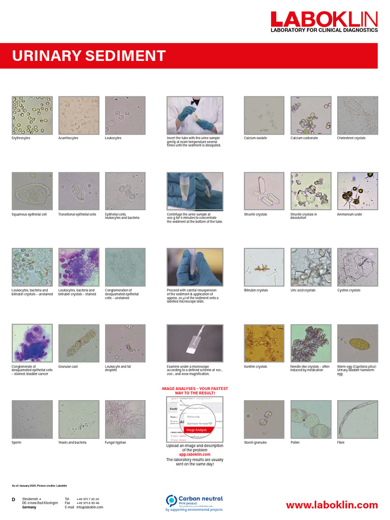 Urinary Sediment Analysis Guide | PDF