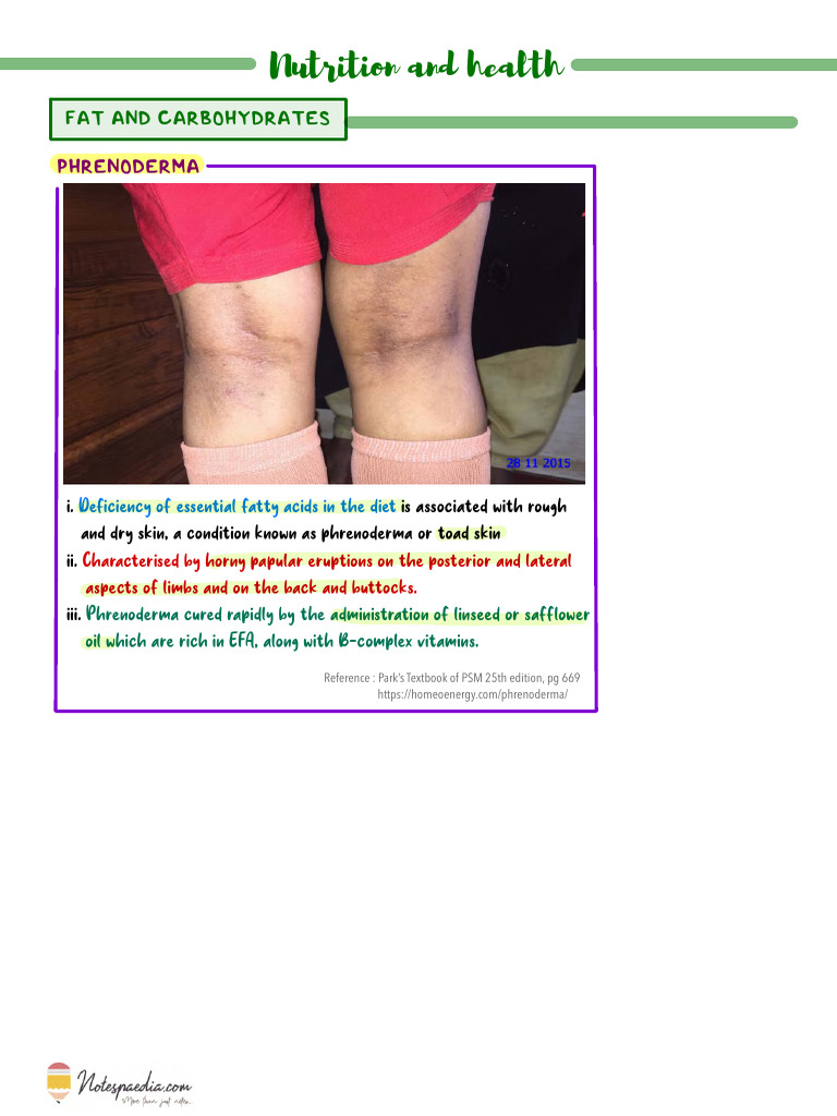 Nutrition and Health, Baby Friendly Hospital Initiative | PDF