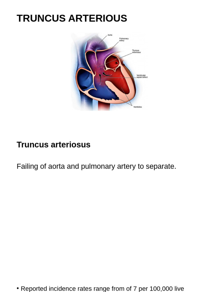 Truncus Arteriosus Overview and Management | PDF