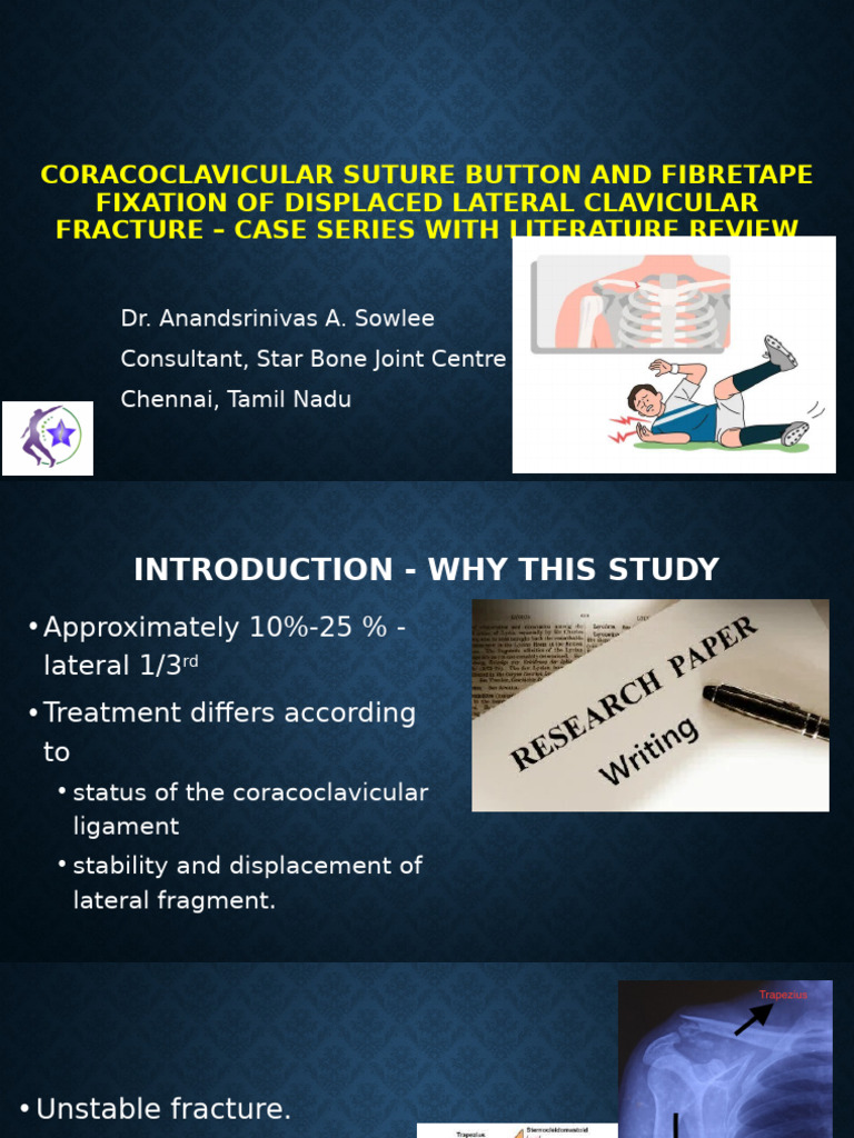 Coracoclavicular Suture Button and Fibretape Fixation | PDF | Injury ...