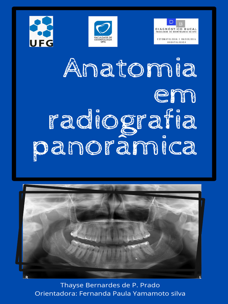 Anatomia em Radiografia Panorâmica | PDF