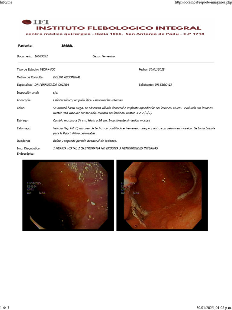 Falacios Amria Isabel | PDF