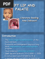 Download Cleft Lip and Palate by Mira Hazwani SN87758103 doc pdf