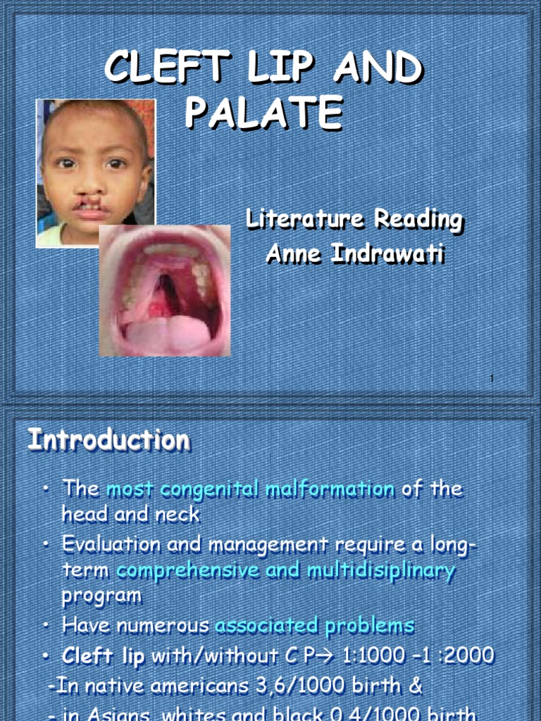 Cleft Lip and Palate PDF Physiognomy Face