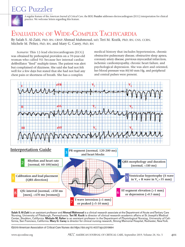 Evaluation of Wide-Complex Tachycardia | PDF | Electrocardiography ...