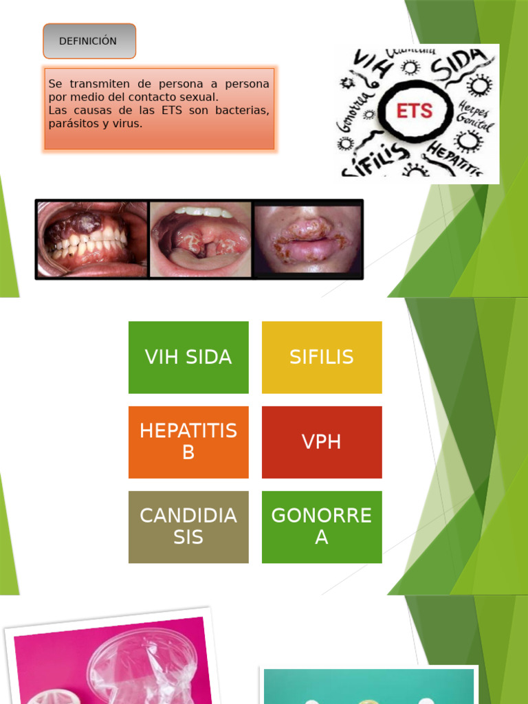 Enfermedades de Transmision Sexual (ETS) | PDF