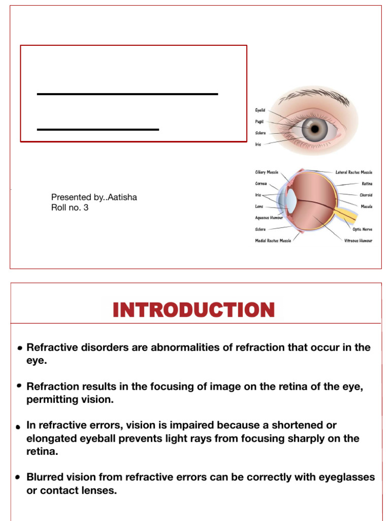 Understanding Refractive Errors | PDF