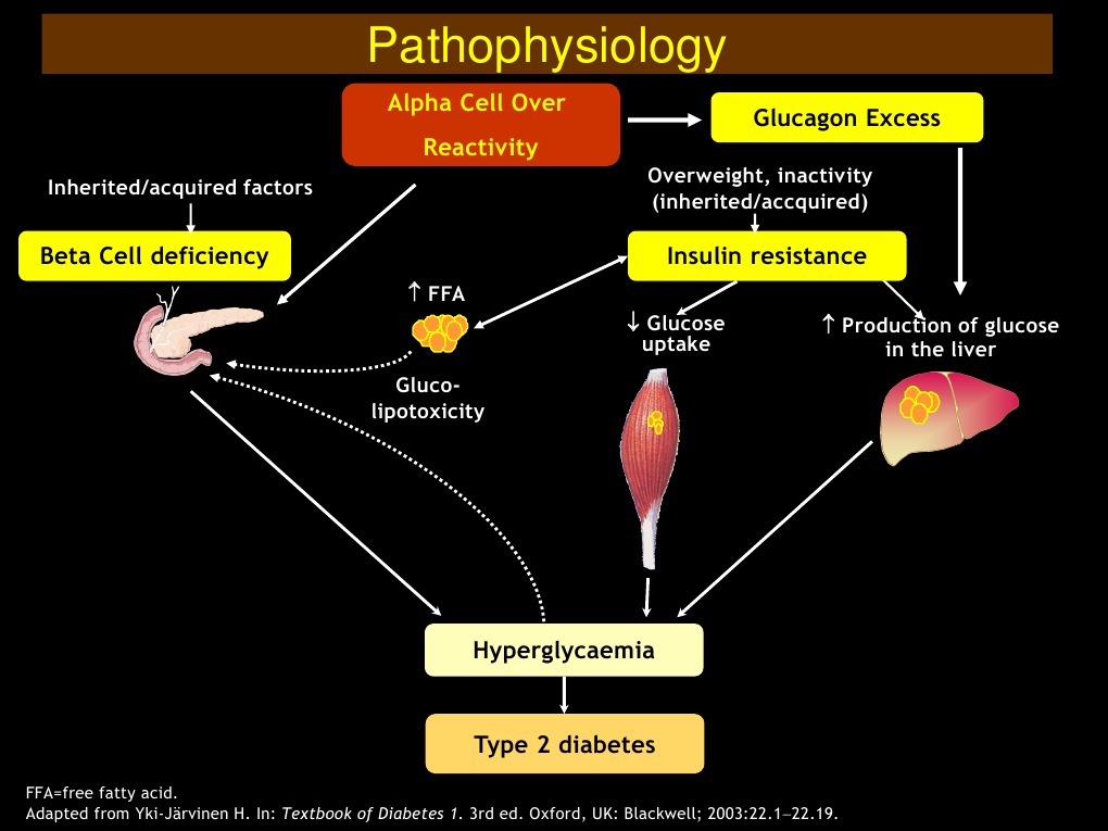 Pathophysiology of Type 2 Diabetes | PDF | Technology & Engineering