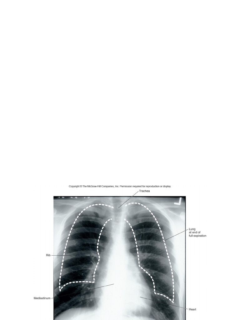 Pulmonary Disorders: Sleep Apnea & Fibrosis | PDF | Respiratory ...