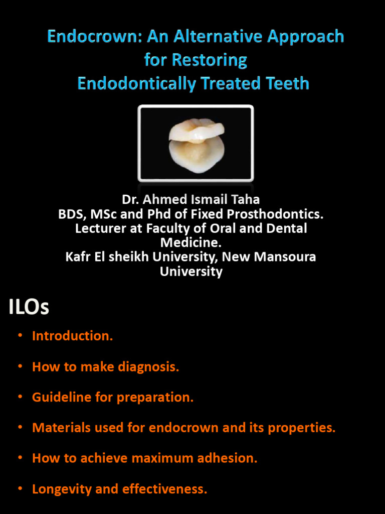 Endocrown Restoration Techniques | PDF | Dental Composite | Dentin