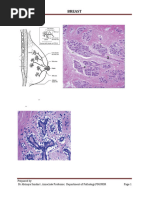 Breast: Kurt'S Notes | PDF | Adenocarcinoma | Epithelium