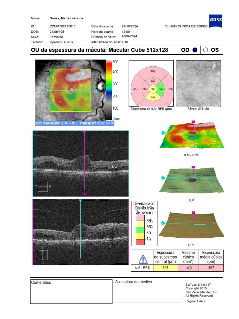 Souza Maria Luiza de CZMI1502275010 19510621 Female Macular Cube ...
