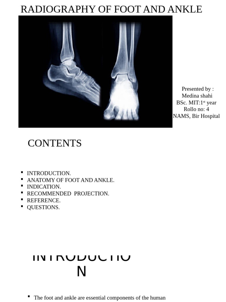 Foot and Ankle Radiography Guide | PDF | Foot | Ankle