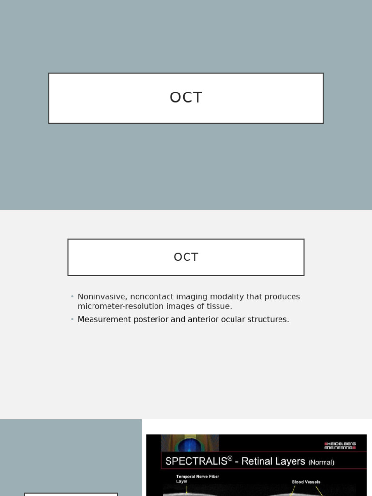 OCT Imaging for Macular Conditions | PDF