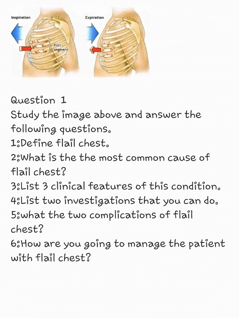 Surgery Question | PDF