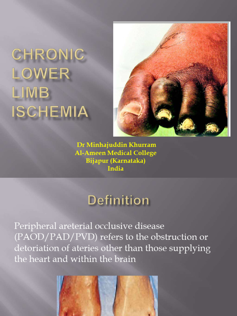 Chroniclowerlimbischemia 140406043541 Phpapp02 | PDF | Coronary Artery ...
