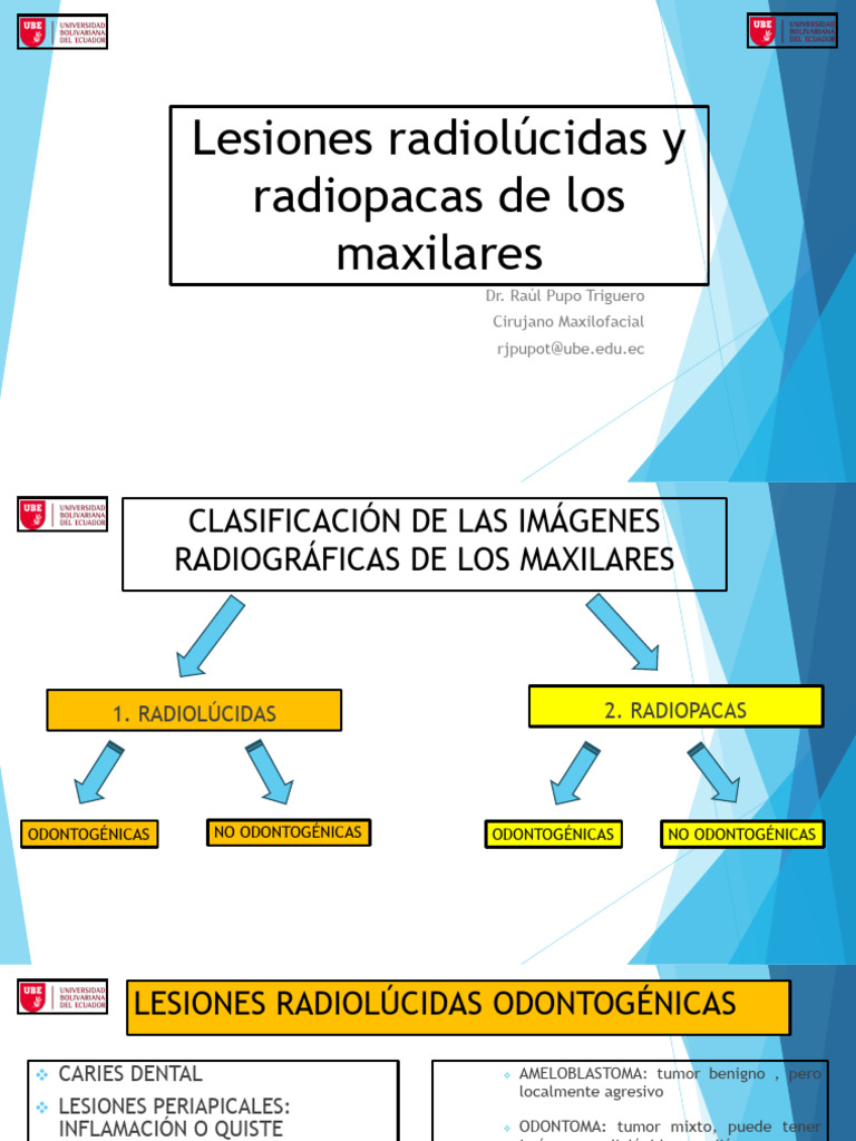 Lesiones Radiolúcidas y Radiopacas | PDF | Neoplasias | Hueso