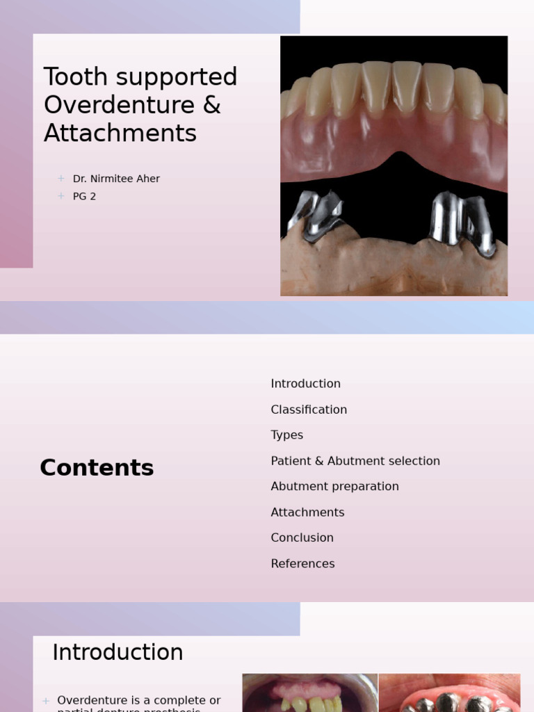 Tooth Supported Overdentures Overview | PDF | Dentistry Branches ...