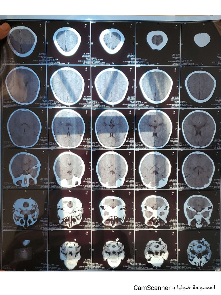Brain Scan With Comprehensive Examinations | PDF