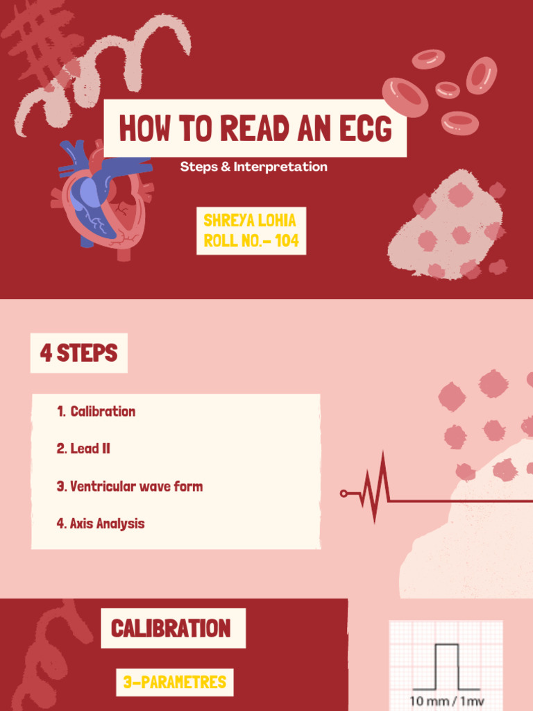 How To Read An Ecg - 20250624 - 113339 - 0000 | PDF ...