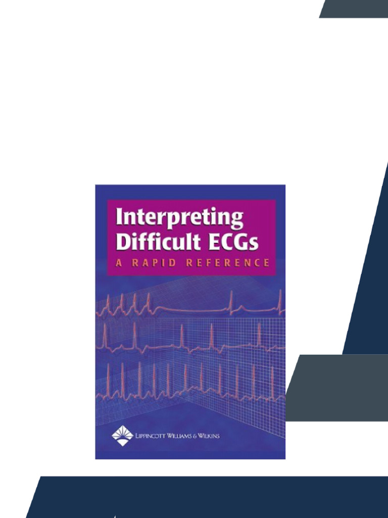 Interpreting Difficult ECGs A Rapid Reference Download | PDF | Project ...