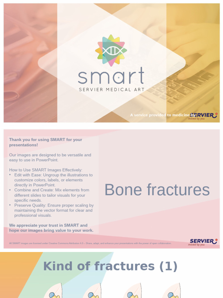 SMART Bone Fractures | PDF | Musculoskeletal System | Skeletal System