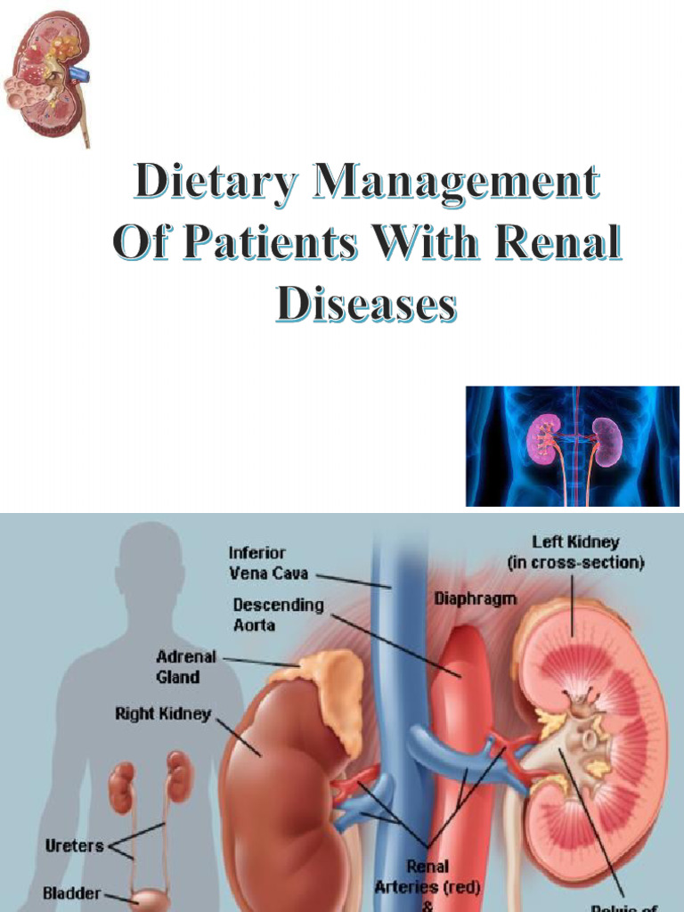 Dietary Management of Renal Diseases | PDF | Kidney | Chronic Kidney ...
