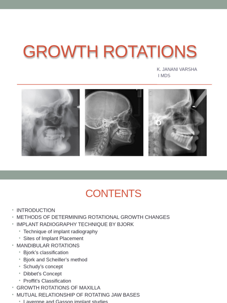 Mandibular Growth Rotations in Orthodontics | PDF | Dental Anatomy ...