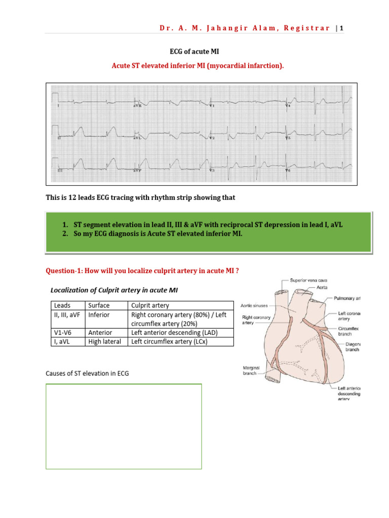 ECG All For Prof | PDF | Myocardial Infarction | Electrocardiography
