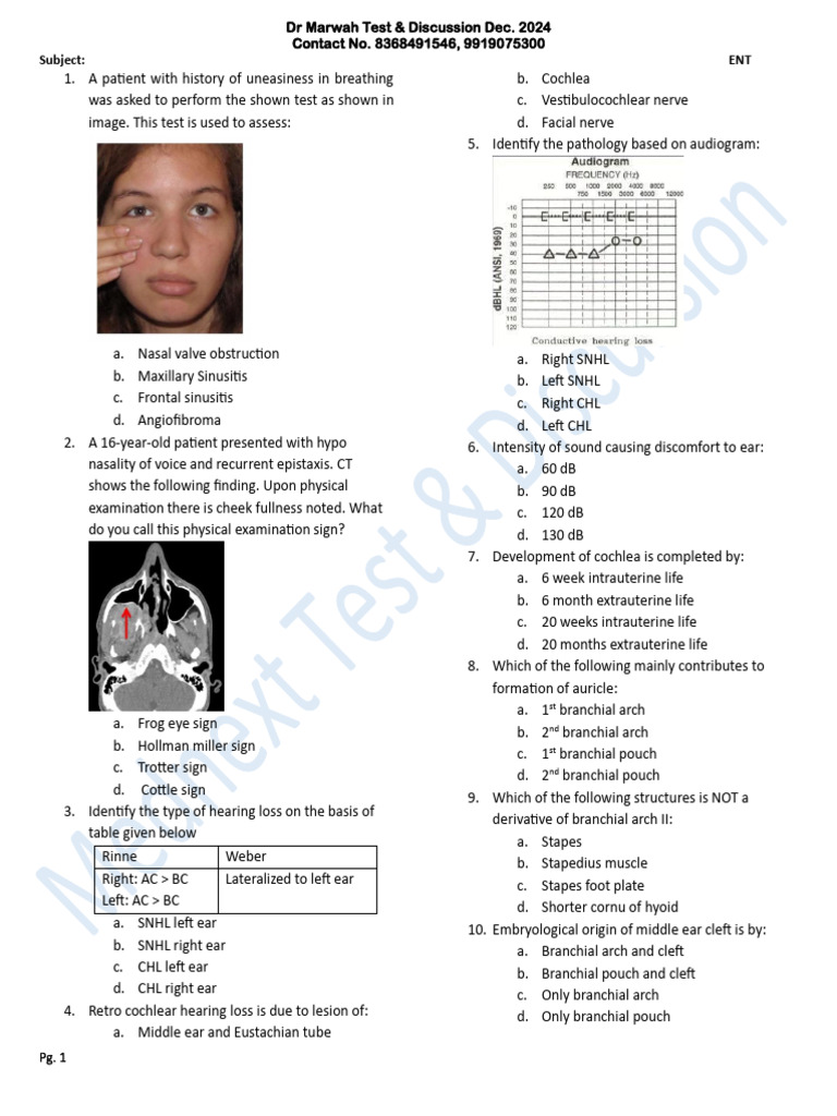 Hitzelberger Sign and Attic Destruction in ENT | PDF | Ear | Larynx