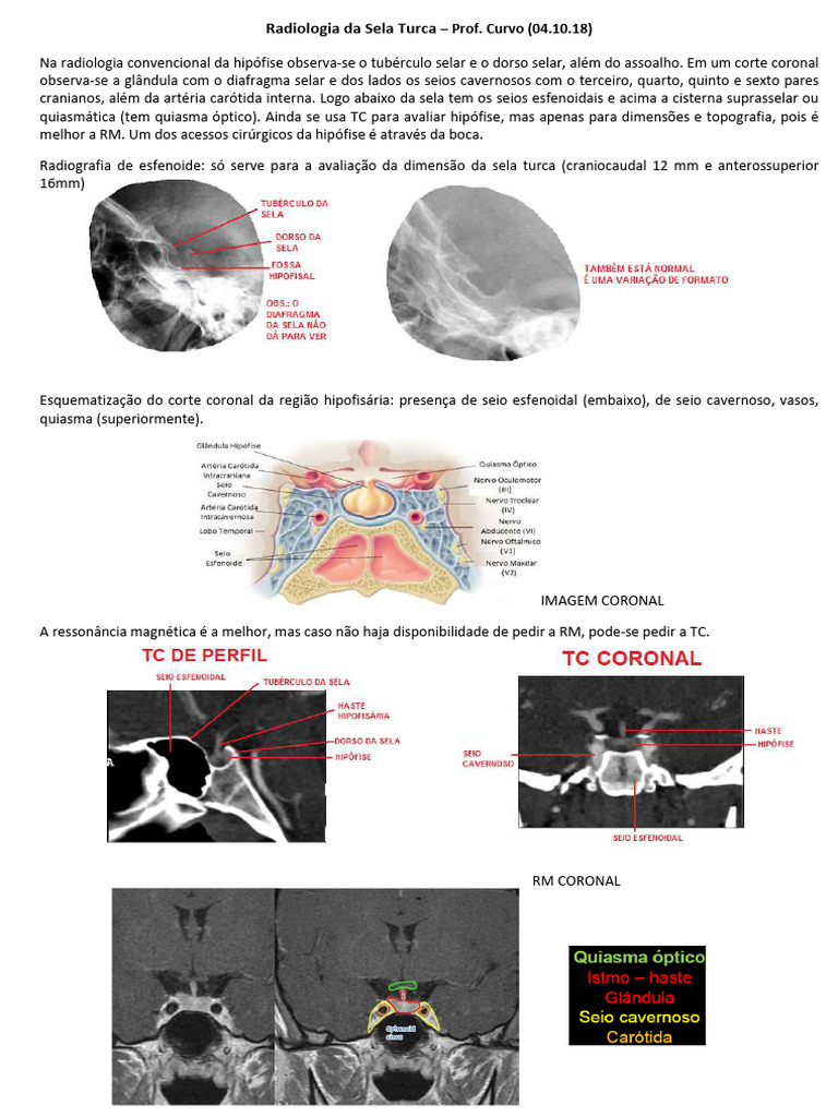Radiologia Da Sela Turca | PDF | Glândula pituitária | Sistema visual, image size:768x1024