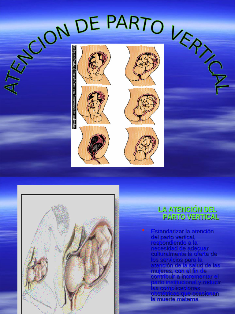 Estandarización del Parto Vertical | PDF | Parto | Salud maternal