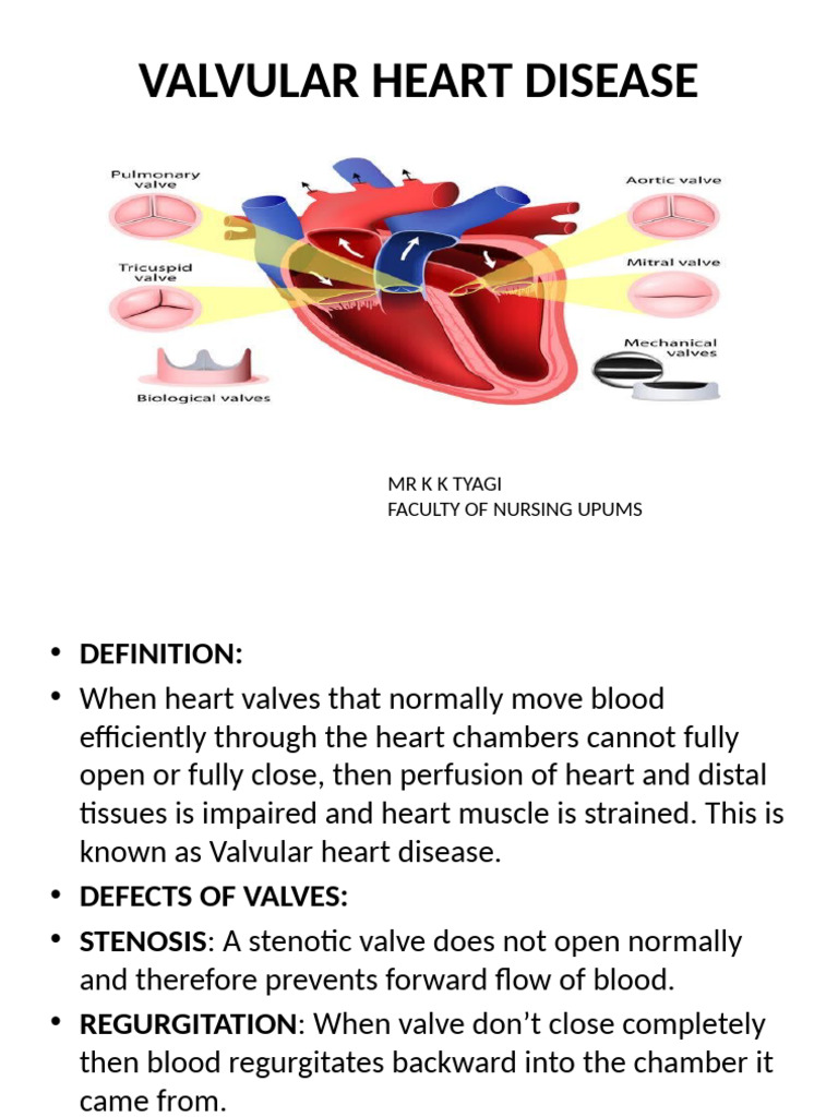 Valvular Heart Disease | PDF | Heart | Diastole