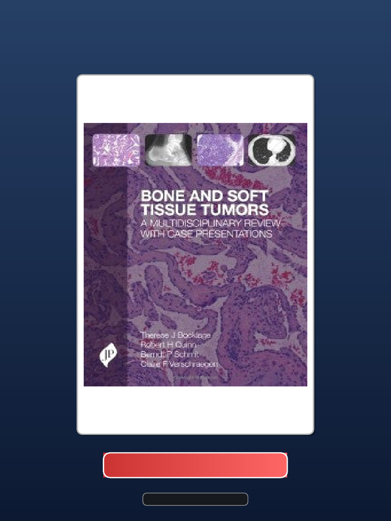 Bone and Soft Tissue Tumours A Multidisciplinary Review With Case ...