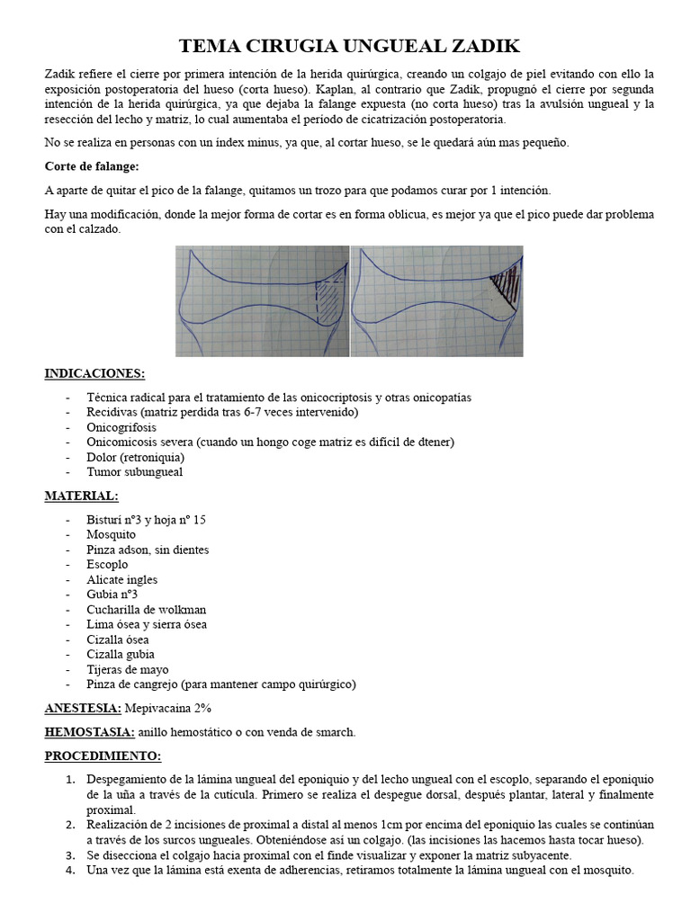 Cirugía Ungueal: Técnica de Zadik | PDF | Cirugía | Clavo (anatomía)