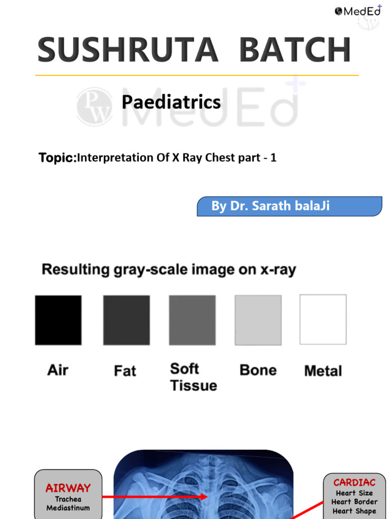 ABCDE X-Ray Chest Interpretation Guide | PDF