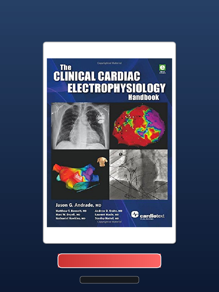 Complete Bundle The Clinical Cardiac Electrophysiology Handbook Ebook ...
