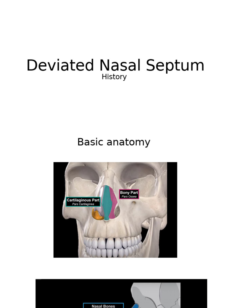 Understanding Deviated Nasal Septum | PDF | Human Nose | Human Anatomy