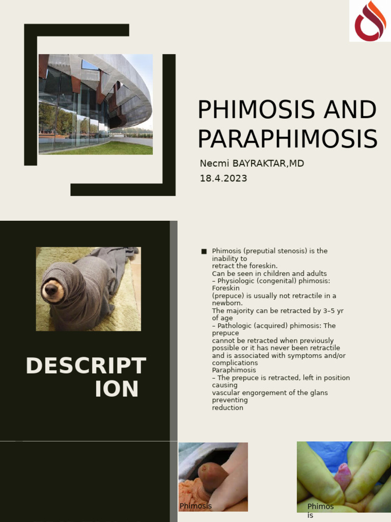 Phimosis and Paraphimosis Overview | PDF | Circumcision | Male Genital ...