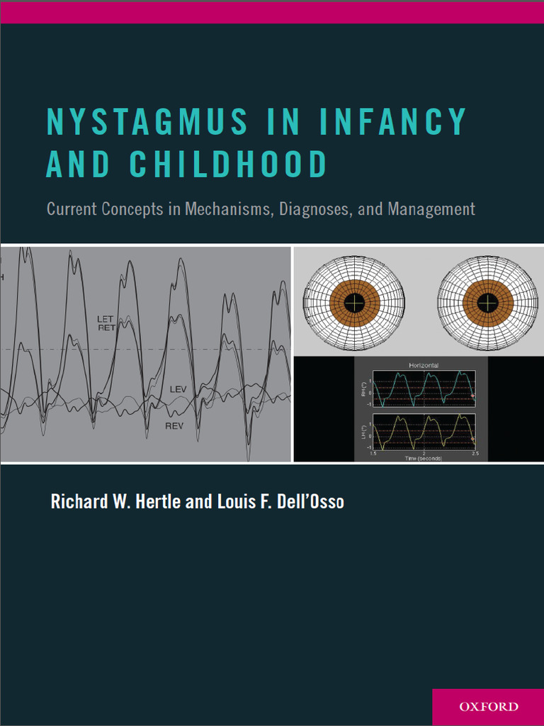 Nystagmus in Infancy and Childhood | PDF | Visual Acuity | Human Eye