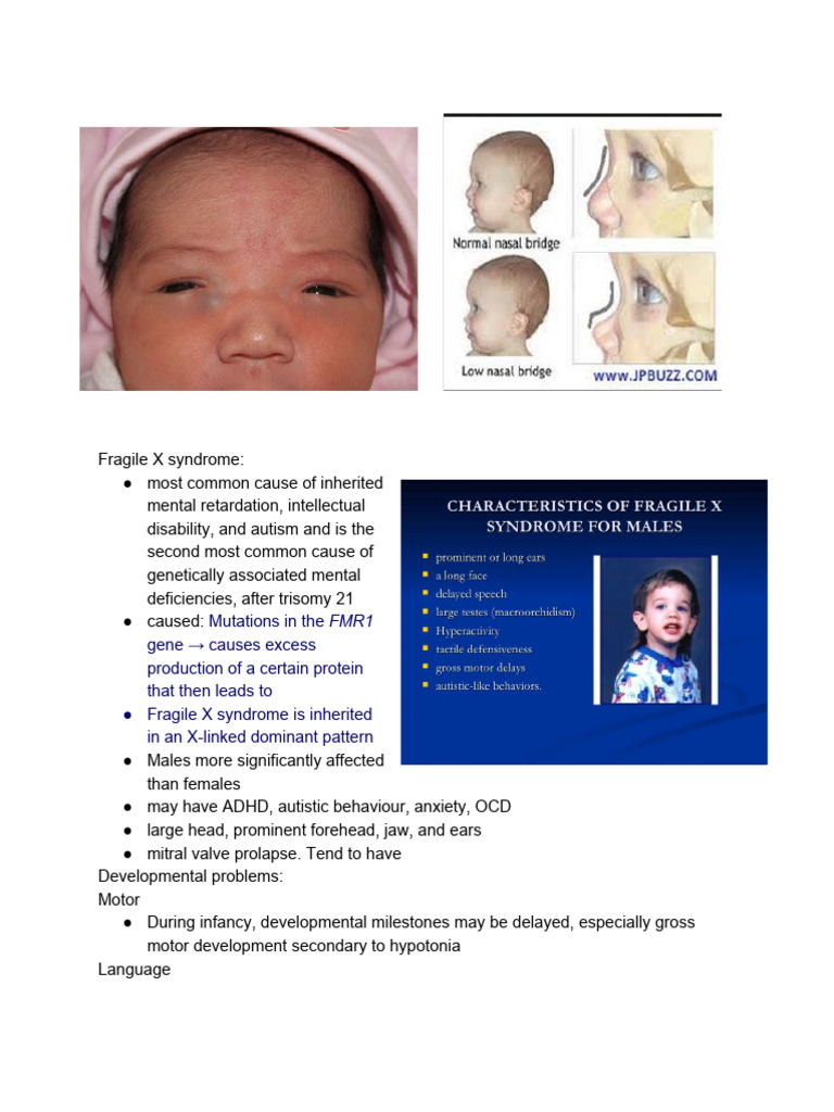 Dysmorphic Features of Down Syndrome | PDF | Down Syndrome | Medical ...