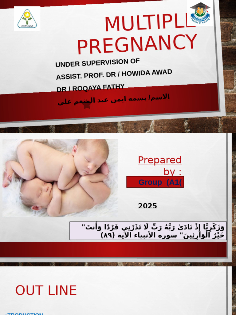 11multiple Pregnancy | PDF | Multiple Births | Childbirth