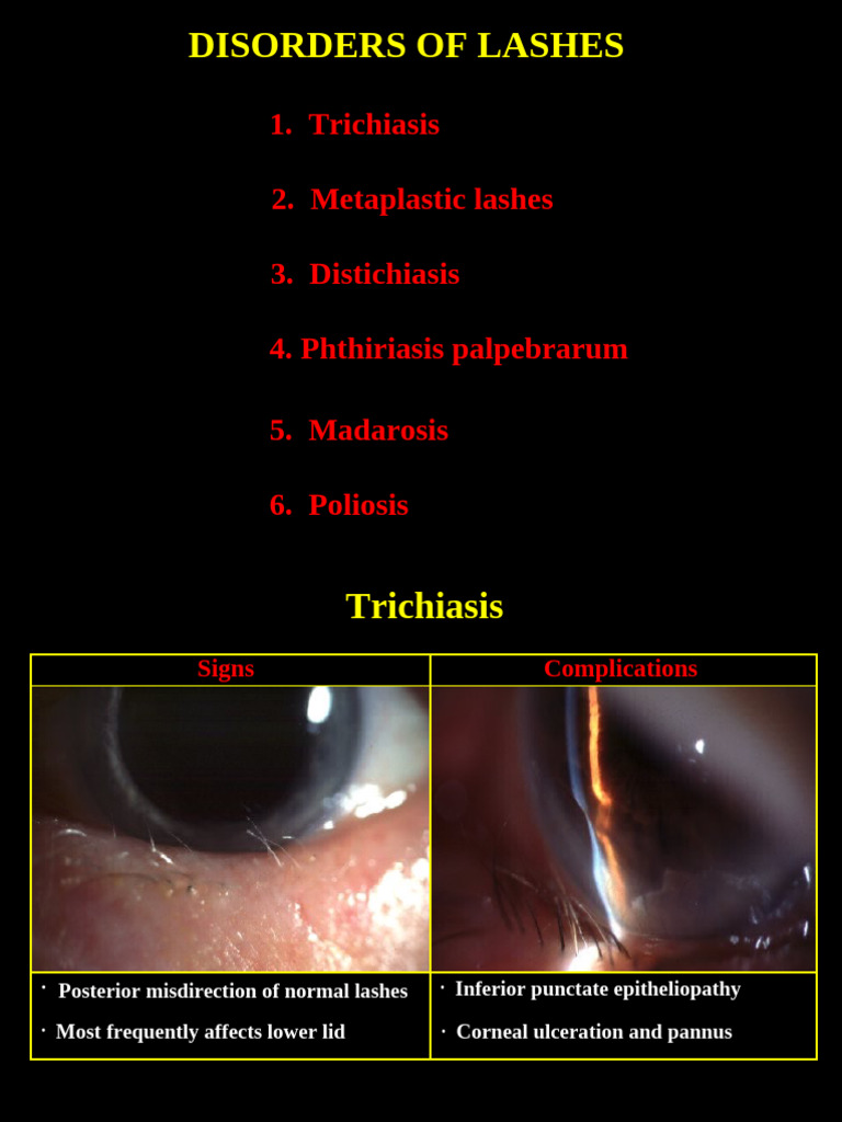 01disorders of Lashes | PDF | Medical Specialties | Diseases And Disorders