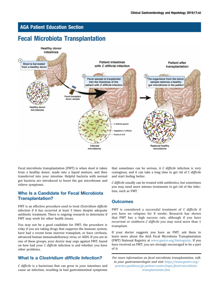 Fecal Microbiota Transplantation Guide | PDF | Infection | Human ...