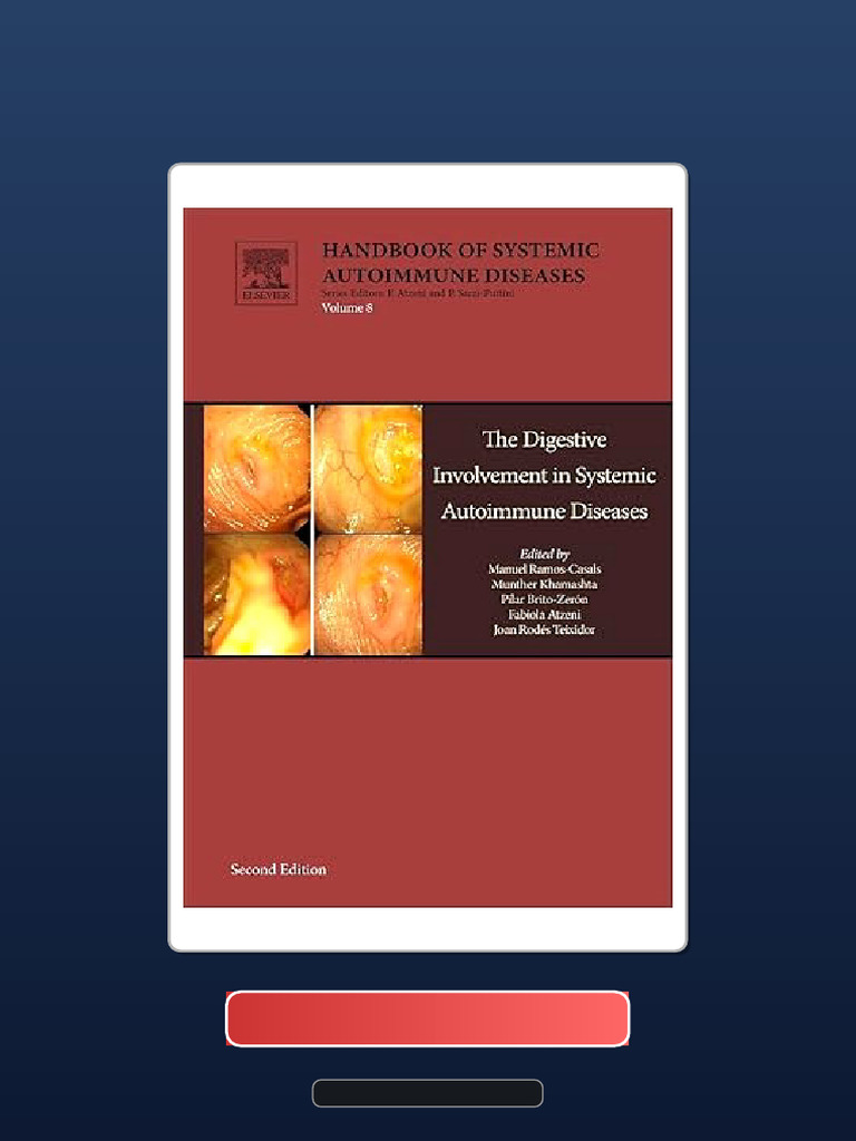 Complete Bundle Antiphospholipid Syndrome in Systemic Autoimmune ...
