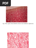 _PCI-urinárioatlas2.pdf_