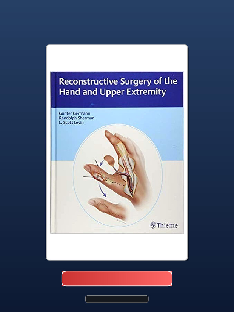 Reconstructive Surgery of The Hand and Upper Extremity Official Test ...