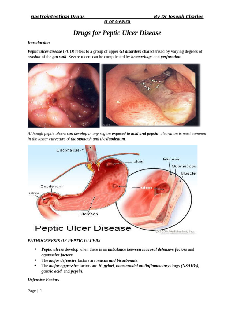 Drugs For Peptic Ulcer Disease 1 | PDF | Stomach | Nonsteroidal Anti ...