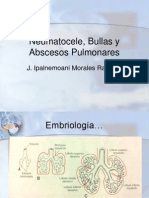 Neumatocele, Bullas y Abscesos Pulmonares